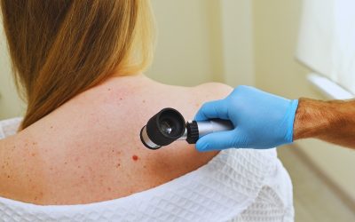 Prevenzione dermatologica: regole d’oro per proteggere la pelle
